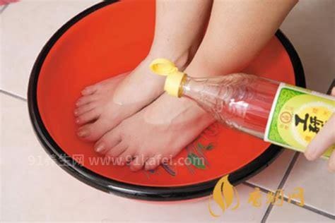 醋精可以泡脚吗