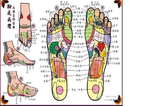 脚底疼痛部位图解