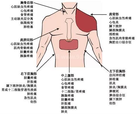 胸口疼痛部位对照表图解大全，帮你解读疼痛发生原因优质