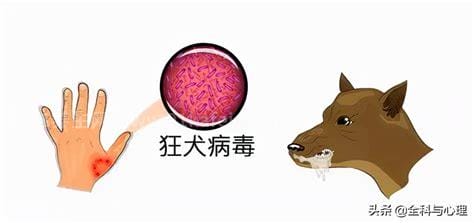 狂犬疫苗最佳时间是多少小时内，是24小时内药效是最好优质