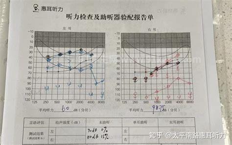 十年耳鸣一针见效，是真的（附具体治疗过程）优质