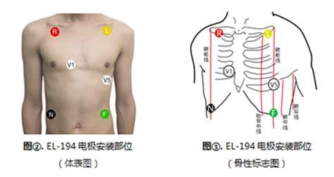 心电监护5个电极位置图及对应颜色，左腿(黑)/右腿(绿)优质