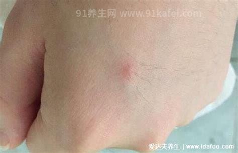 猫抓伤狂犬病几乎为0，不可靠这4种情况必须打疫苗