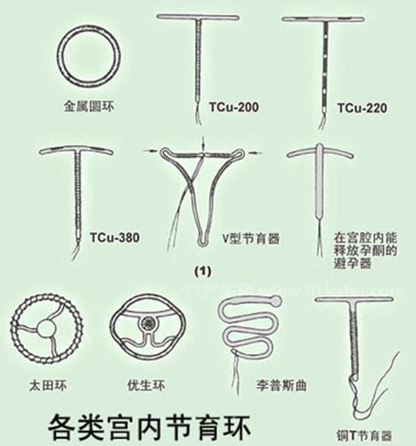 避孕环是什么样子图片，避孕环种类大全(胆小勿看)