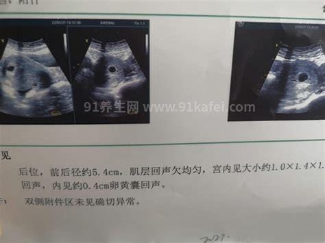 生男生女其实看孕囊很准，看6-7周孕囊大小的两个数据准爆了