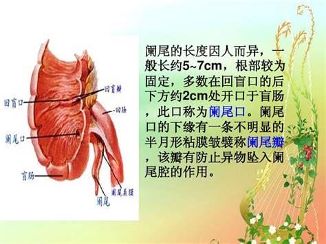 女性阑尾炎的疼痛位置图片，会转移性右下腹按压痛(刚开始上腹肚脐疼)