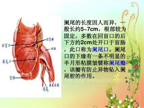 人体阑尾炎的疼痛位置图片，在右下腹肚脐周围（男性更易得阑尾炎）