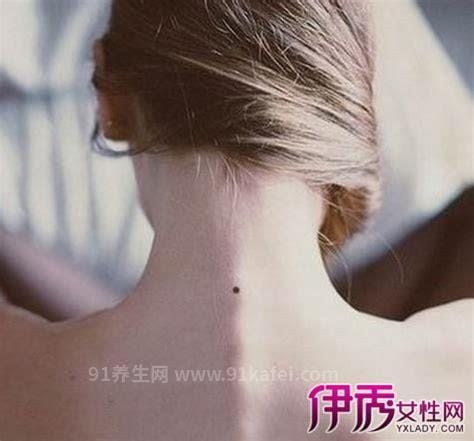 脖子后面有痣代表什么意思，说明人旺运势好(男女有痣都很吉利)