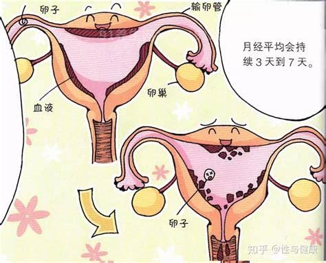 女性子宫内膜脱落真正图片，碎片脱落