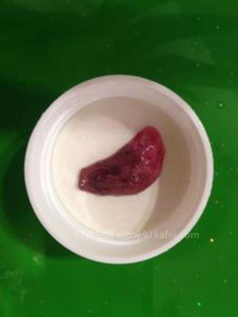 流产孕囊掉下来的图片，粉白色透明圆