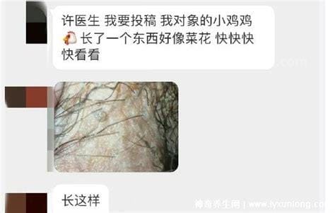 尖湿锐尤典型图片，尖锐湿疣早期症状真假辨别