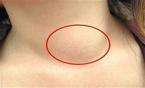 女人艾滋病的三大症状图片，宫颈有红色水泡要注意(附自查方法)