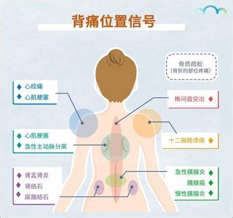 身体各部位疼痛对照图，包括腹部/腰