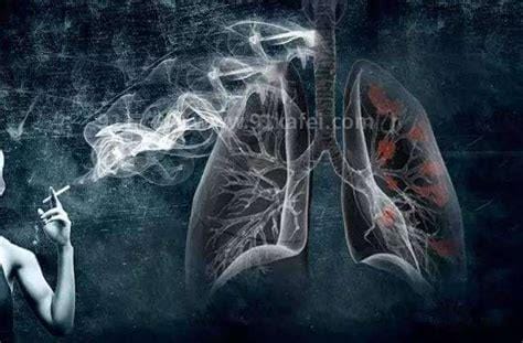 抽了一年电子烟的肺部图片，与普通香烟对比危害还要大