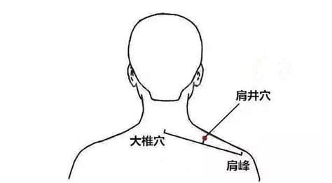 肩井穴的准确位置图及作用功效，治颈