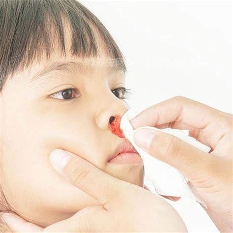 小孩鼻子出血七种原因，除了天气干燥