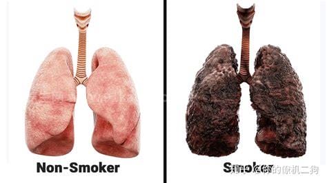 吸烟者的肺，吸烟的肺太恐怖了