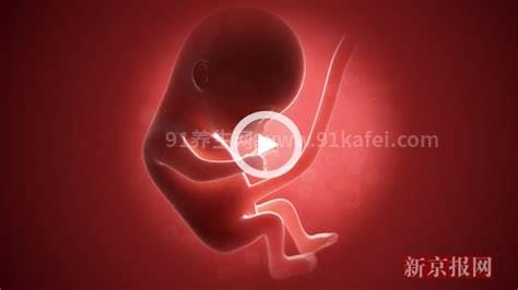 孕妇产罕见胎中胎 寄生胎取出来后