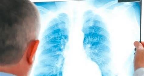 十个肺结节九个是癌，假的发病率也才10%-20%优质