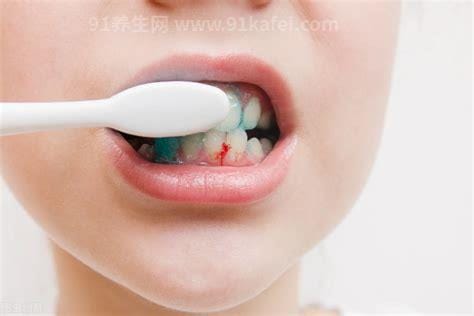 牙龈老是出血怎么办