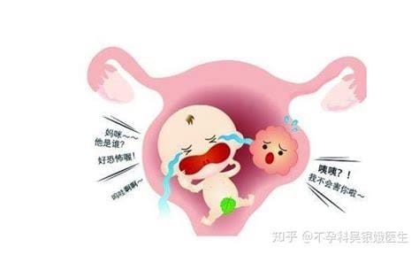子宫息肉影响怀孕吗