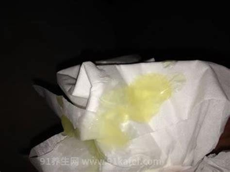 精液不液化能怀孕吗