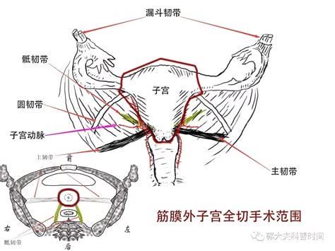 阴道后穹窿部是什么