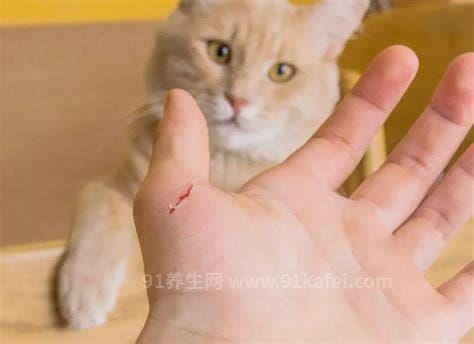 被自家的猫抓伤出血了不打针可以吗