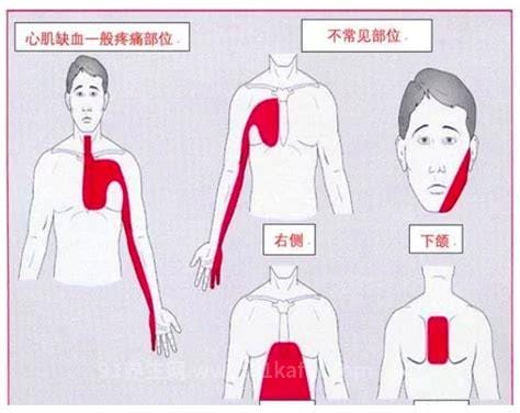 心绞痛发作的典型部位