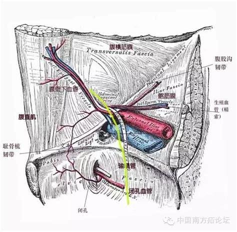 腹股沟小肉粒