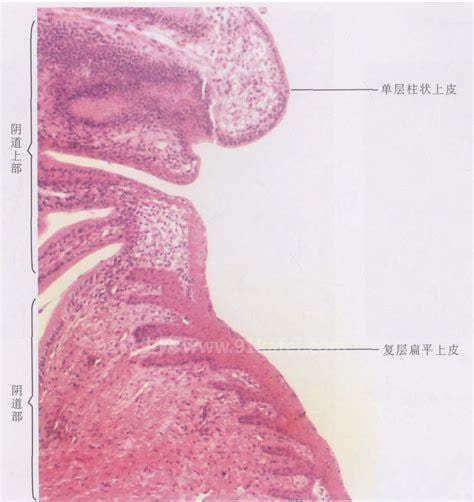 有颈管细胞是正常的吗