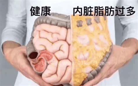 内脏脂肪是什么原因造成的