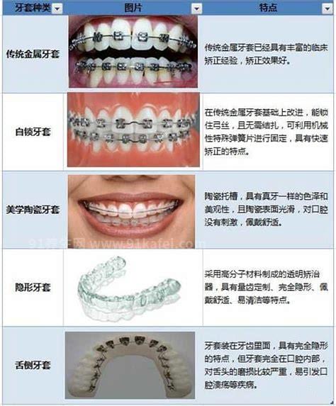 各种牙齿矫正器的区别是什么