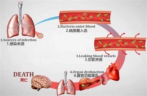 败血症病原诊断标准