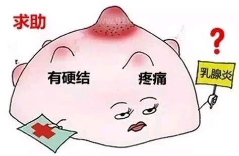 乳腺炎怎么判断自己化脓了