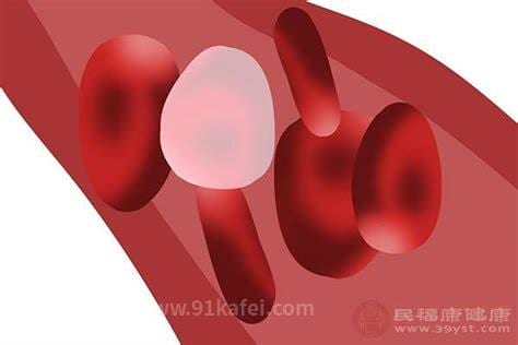 高密度脂蛋白偏低0.8怎么办