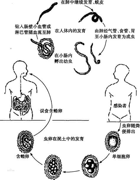 蛔虫多大年龄就没有了