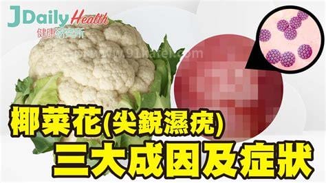 椰菜花病怎么治疗