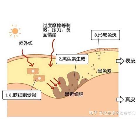 什么食物可以促进黑色素生成