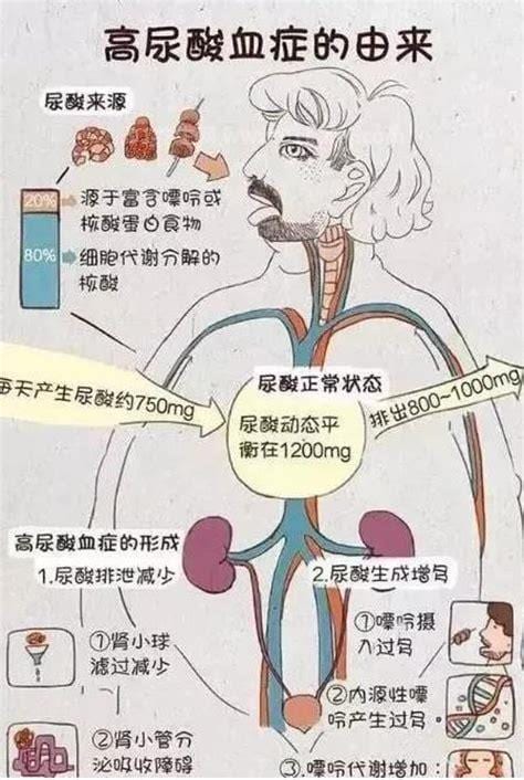 pth高是什么原因