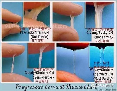 正常白带和别的白带的区别