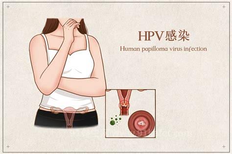 女性持续感染HPV病毒，白带若出现这