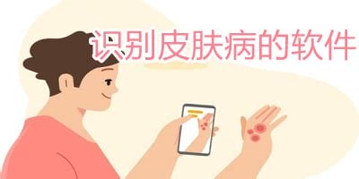 扫一扫识别皮肤病app，4款手机软件准