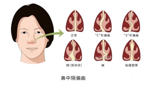 五官最危害颜值位置，眼睛第一体验/