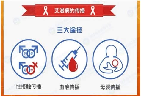 艾滋病传染必须有五个条件，需要达到