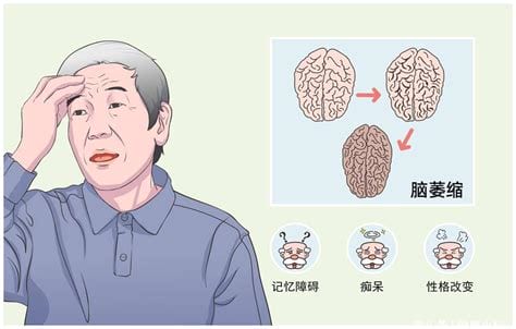 老年人脑萎缩能康复吗