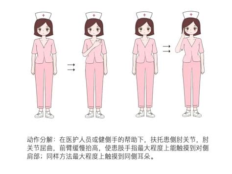 乳腺癌术后功能锻炼