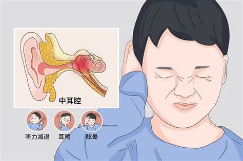 噪音性耳鸣应该怎样治疗