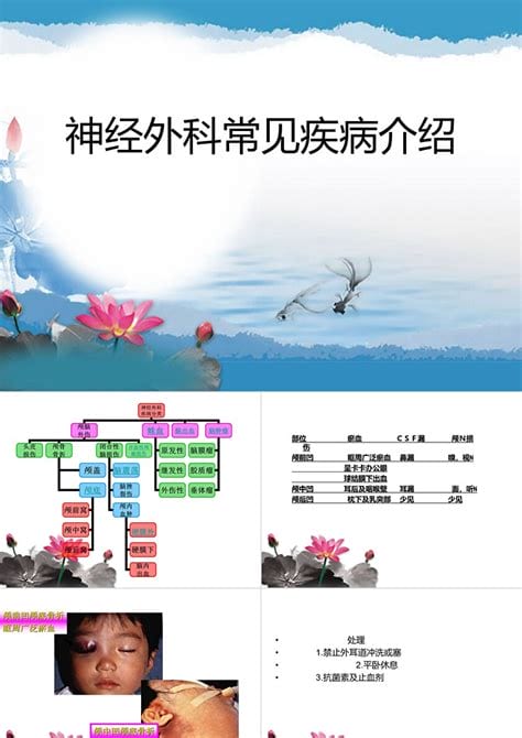 神经外科疾病有哪些