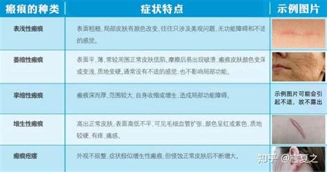 面部擦伤如何修复不留疤痕